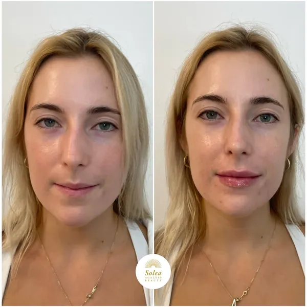 Before and after treatment result