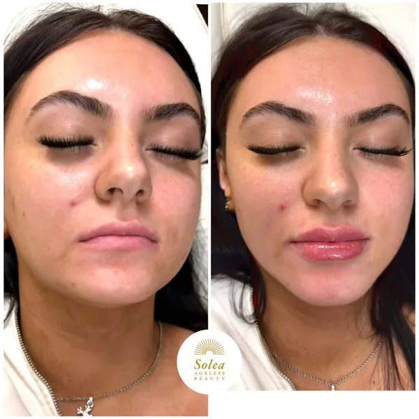 Before and after treatment result