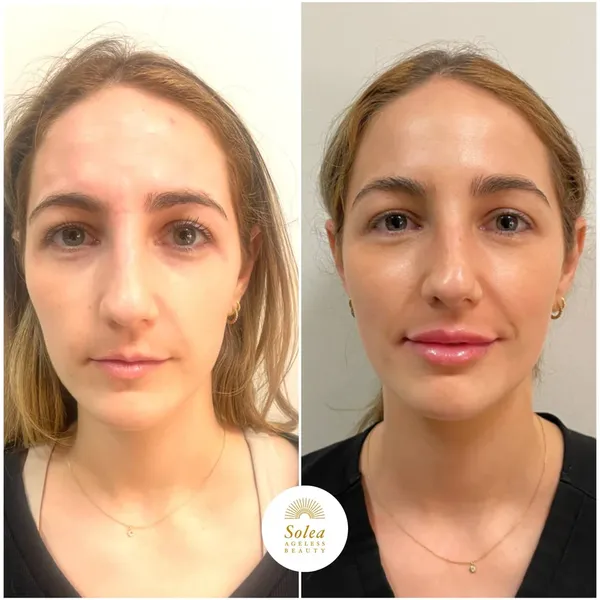 Before and after treatment result