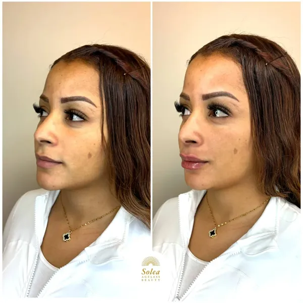Before and after treatment result
