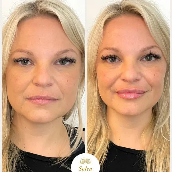 Before and after treatment result