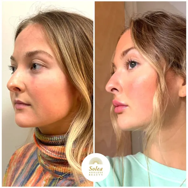 Before and after treatment result