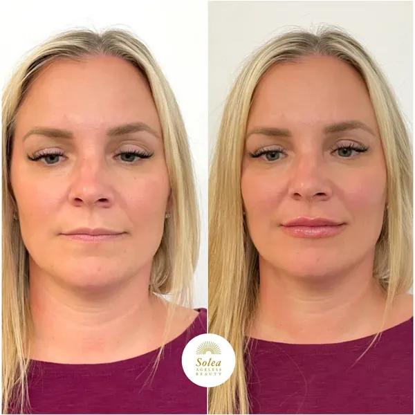Before and after treatment result