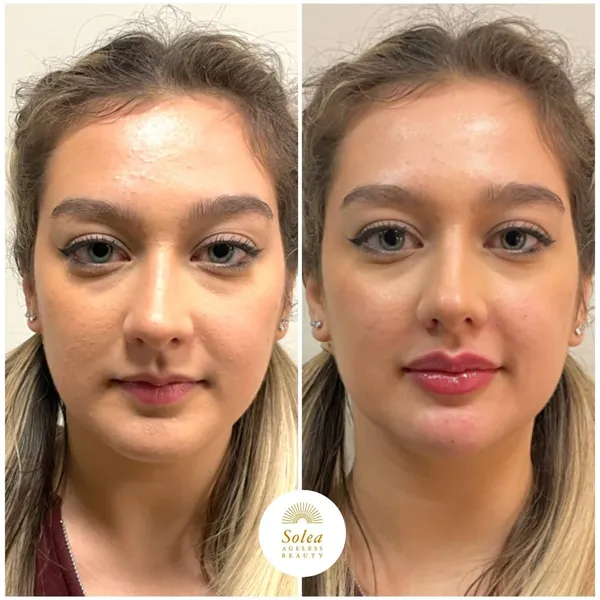 Before and after treatment result