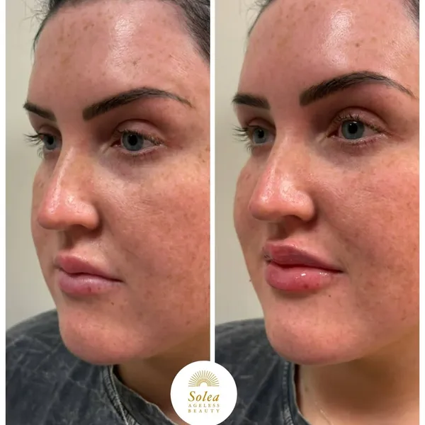 Before and after treatment result