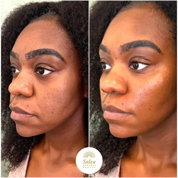 Before and after treatment result