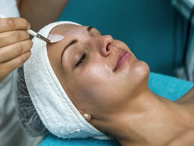 Chemical peel treatment